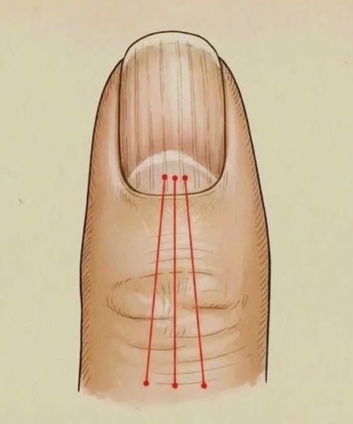 646826932 122102478639275841 1124022485647370920 n