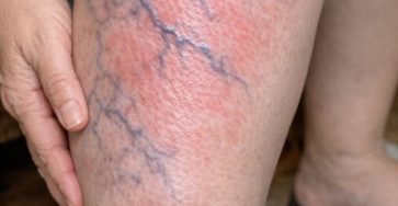 657429480 2039449563581361 8902580095200886509 n