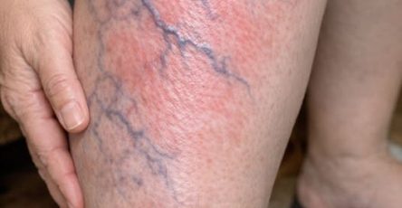 657429480 2039449563581361 8902580095200886509 n