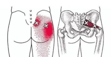 658200951 122160144398402701 6409850685956827828 n