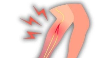 669729057 122194899818521528 8799715873962772160 n